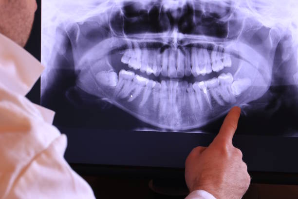Best Same-Day Emergency Dentist in Nroe City, MO
