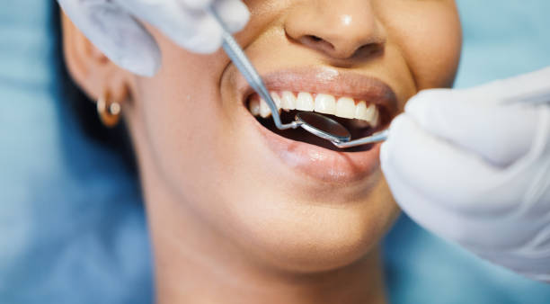 Best Emergency Tooth Extraction in Nroe City, MO