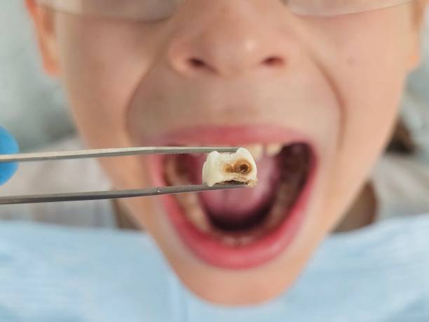  Nroe City, MO Emergency Dentist Pros